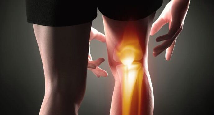 Symptome der Arthrose
