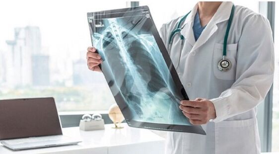 Röntgendiagnostik bei Schmerzen unter dem linken Schulterblatt