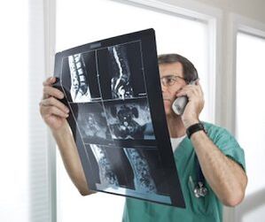 Myelographie zur Diagnose von Osteochondrose und Zwischenwirbelhernien